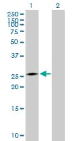 Abcam&nbsp;CIDE A overexpression 293T lysate (whole cell).