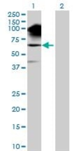 Abcam&nbsp;Synphilin 1 overexpression 293T lysate (whole cell).
