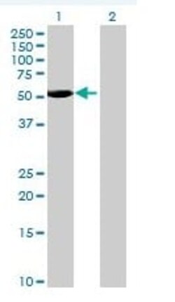 Abcam&nbsp;BLK overexpression 293T lysate (whole cell).
