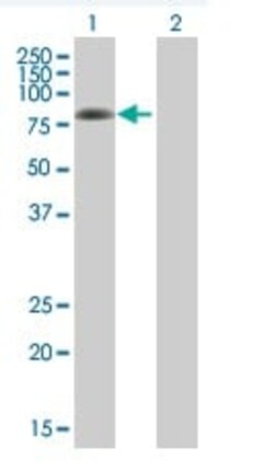 Abcam&nbsp;PKC delta overexpression 293T lysate (whole cell).