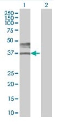 Abcam&nbsp;CD147 overexpression 293T lysate (whole cell).