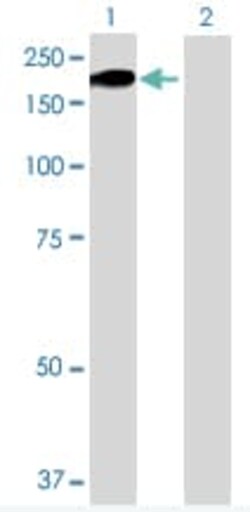 Abcam&nbsp;Thrombospondin 1 overexpression 293T lysate (whole cell).
