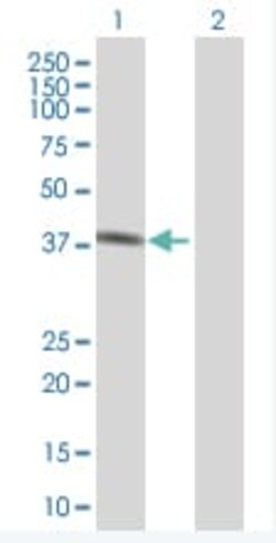 Abcam&nbsp;Pepsinogen II/PGC overexpression 293T lysate (whole cell).