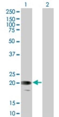 Abcam&nbsp;Glycophorin C overexpression 293T lysate (whole cell).