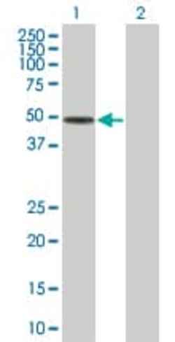 Abcam&nbsp;Factor I overexpression 293T lysate (whole cell).