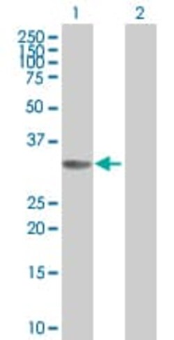Abcam Cyclin D2 overexpression 293T lysate (whole cell).