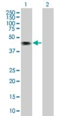 Abcam&nbsp;CD43 overexpression 293T lysate (whole cell).