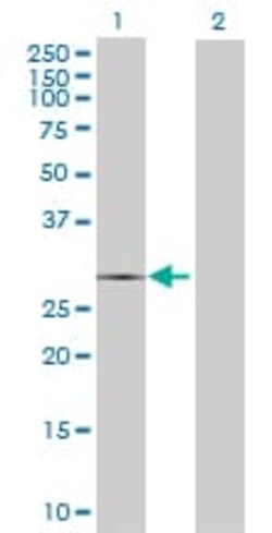 Abcam&nbsp;Cathepsin G overexpression 293T lysate (whole cell).