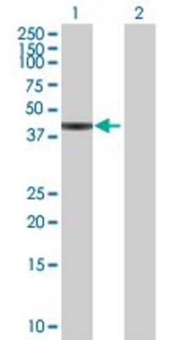 Abcam&nbsp;Carboxypeptidase B overexpression 293T lysate (whole cell).
