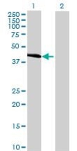 Abcam&nbsp;Carboxypeptidase A overexpression 293T lysate (whole cell).