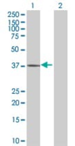 Abcam&nbsp;Liver Arginase overexpression 293T lysate (whole cell).
