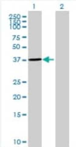Abcam&nbsp;Annexin-2/ANXA2 overexpression 293T lysate (whole cell).