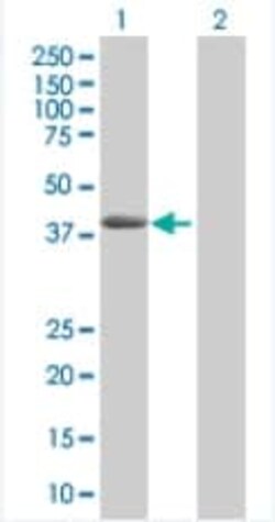 Abcam&nbsp;AACT overexpression 293T lysate (whole cell).