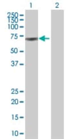 Abcam&nbsp;M-CSF overexpression 293T lysate (whole cell).