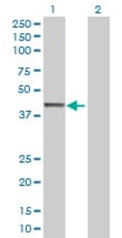 Abcam CNPase overexpression 293T lysate (whole cell).