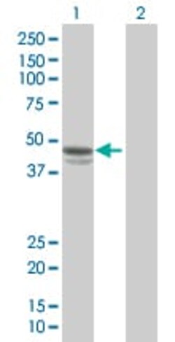 Abcam&nbsp;PAI1 overexpression 293T lysate (whole cell).