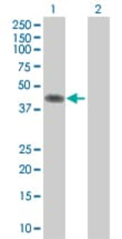 Abcam&nbsp;PAI1 overexpression 293T lysate (whole cell).