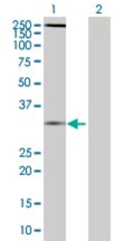 Abcam&nbsp;CXCR6 overexpression 293T lysate (whole cell).