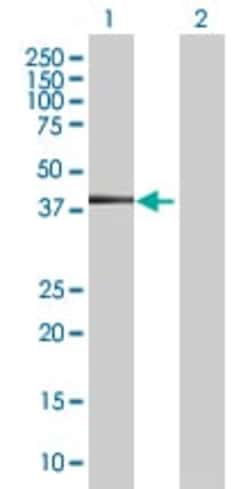 Abcam&nbsp;Cytokeratin 19 overexpression 293T lysate (whole cell).