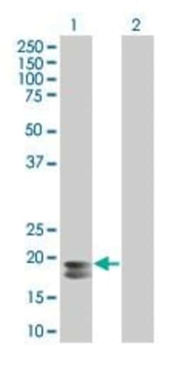 Abcam&nbsp;Prolactin/PRL overexpression 293T lysate (whole cell).