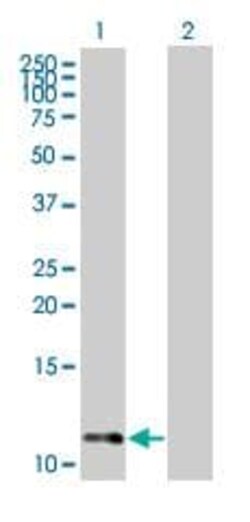 Abcam&nbsp;RPA14/RPA3 overexpression 293T lysate (whole cell).