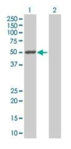Abcam&nbsp;MMP1 overexpression 293T lysate (whole cell).