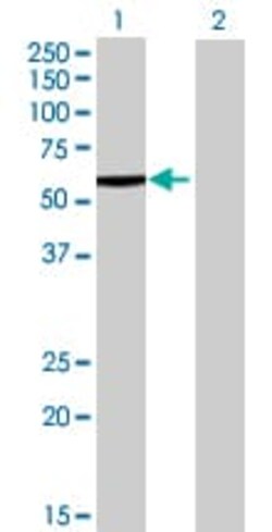 Abcam&nbsp;Liver Carboxylesterase 1 overexpression 293T lysate (whole cell).