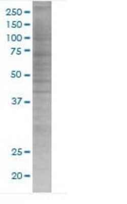 Abcam&nbsp;Granzyme B overexpression 293T lysate (whole cell).