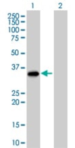 Abcam Granzyme B overexpression 293T lysate (whole cell).