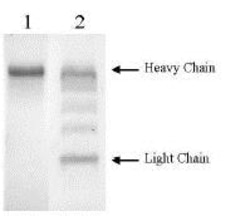 Abcam Native rabbit Plasmin protein