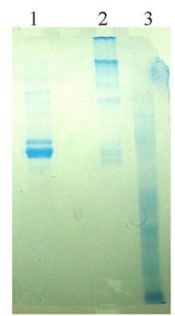 Abcam Native Human Vitronectin/S-Protein, 100UG
