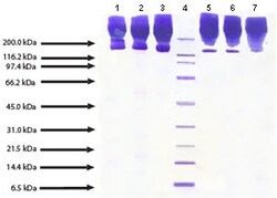 Abcam&nbsp;Native Human Apolipoprotein B, 500UG