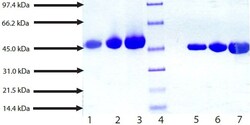 Abcam Native Human Vitamin D Binding protein.