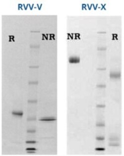 Abcam Native rabbit Thrombomodulin protein, 50UG