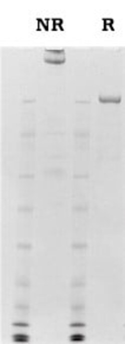 Abcam&nbsp;Native Human Von Willebrand Factor protein, 100UG