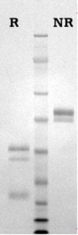 Abcam Native cow Protein C, 50UG
