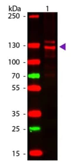 Abcam&nbsp;Native Human Collagen I protein, 500UG