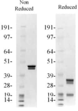 Abcam Native human Prethrombin 2 protein, 250UG
