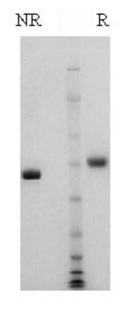 Abcam Native Human Factor VII protein, 20UG