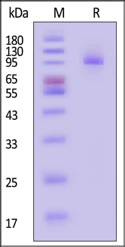 ACROBiosystems Biotinylated Mouse PSMA / FOLH1 Protein, His,Avitag, Quantity: