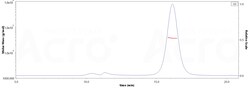 ACROBiosystems SARS-CoV-2 ORF8 Protein, His Tag (MALS verified), Quantity: