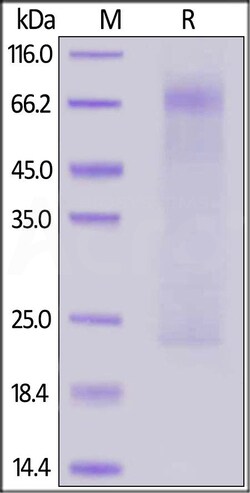 ACROBiosystems MERS Nucleocapsid protein, His Tag, Quantity: Each of 1