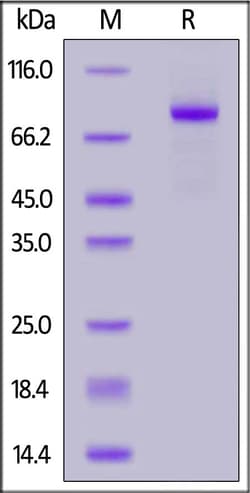 ACROBiosystems Biotinylated Human LRP-5 Protein, His,Avitag, Quantity: