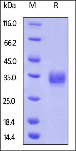 ACROBiosystems Biotinylated Human LAIR1 / CD305 Protein, His,Avitag, Quantity: