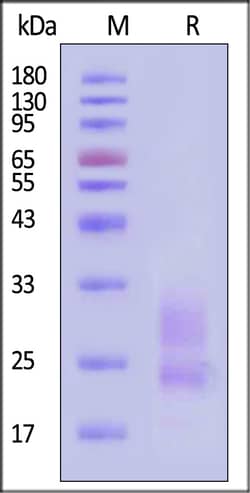 ACROBiosystems Biotinylated Cynomolgus KLRG1 Protein, His,Avitag, Quantity: