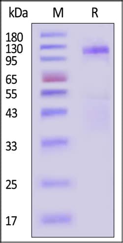 ACROBiosystems Dog Insulin R / CD220 (28-956) Protein, His Tag, Quantity: