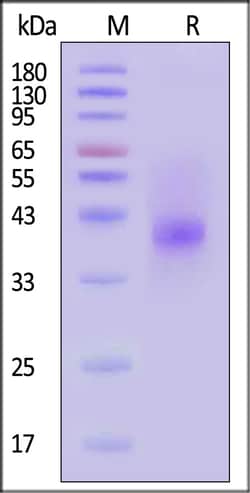 ACROBiosystems Biotinylated Human IL-28 R alpha Protein, His,Avitag, Quantity: