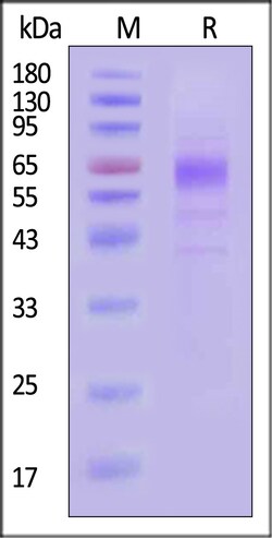 ACROBiosystems Rhesus macaque CD229 / SLAMF3 (X152E) Protein, His Tag,