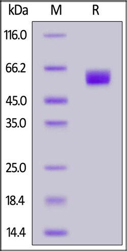 ACROBiosystems FITC-Labeled Human CD98 Protein, His Tag, Quantity: Each