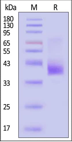 ACROBiosystems Mouse CCR5 Protein, Flag,His Tag (Detergent), Quantity: